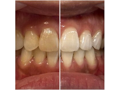 Whitening Salon muku.の写真