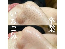 ノート(Naught)/CANAEL式毛穴エクストラ洗浄　鼻