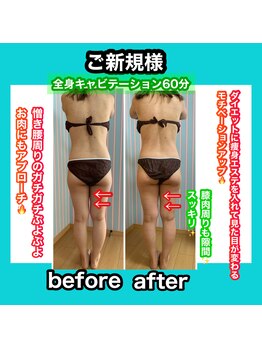 ビューティ ウィッチ(Beauty Witch)/