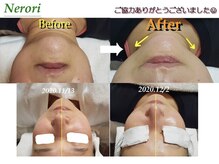 リラクゼーションサロンネロリ/小顔&引き上げといえば