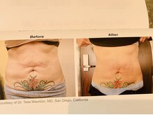 ラナクラニ/ビフォーアフター