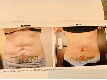 ラナクラニ/ビフォーアフター