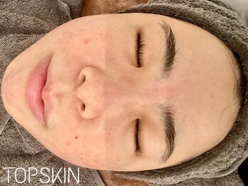 トップスキン 名駅(TOPSKIN)/美白にも効果◎肌まるごと美肌へ