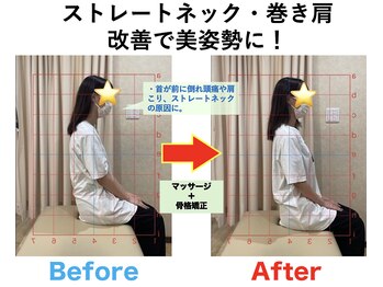 八乙女マイル接骨院/姿勢分析で根本改善！