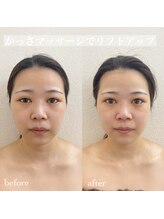 てづか整骨院 西都院/潤う艶肌フェイシャル