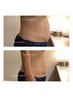 アソート回数券【痩身】全身＋半身＋部分ケア　4回分　49800円