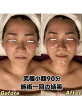 アユスリム(AYU SLIM)/一回でも変化できるの充実小顔