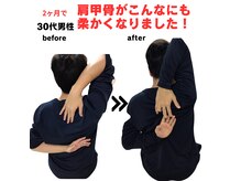 30代男性！長年の肩こりからの脱却！驚くほど身体が軽い！