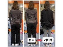 カワル整体 上通り院/姿勢矯正の真実