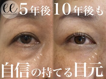 モンステラ(MONSTERA)の写真/まつげパーマで理想の目元へ。アイパワーエステで目元の土台から整える。眉毛とLEDマツエクも◎