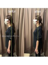 アイリー(Irie)/骨格矯正