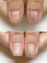 マリーロール 淀屋橋本店(Marie Laure)/自爪育成/深爪矯正/ネイルケア