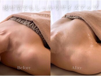 エメ(Aimee)/バストアップエステ