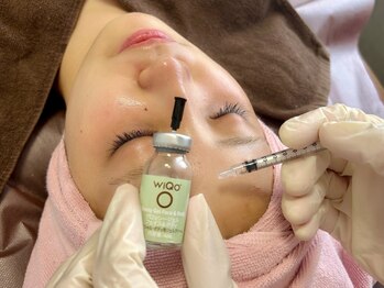 ルチルス(Rutiles)の写真/【WiQoW水光ピール】人気のマッサージピール・コラーゲンピールのエステ版登場★効果&満足度も◎