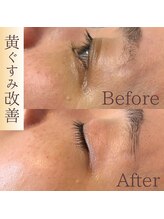 アネーロ(Anhelo)/継続することでお肌を育てます