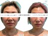 〈小顔・乾燥ケア☆〉 EMS美容液導入＋デコルテマッサージ　￥4,980