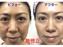 ヴィーナスハンドの雰囲気(大人気★ハーブピーリング(ハーバルシー)スピーディーな肌改善)