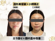 エモシオン トウキョウ(EMOTION TOKYO)/造形フェイス