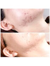 スリリアン 銀座/★お客さまビフォーアフター★