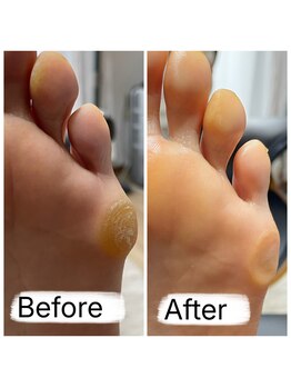 フットファースト 名古屋池下店/岩のようなタコ！