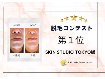 スキンスタジオトウキョウ(SKIN STUDIO TOKYO)の写真