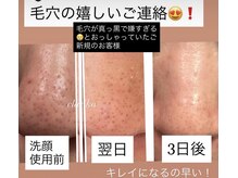 ヘアメイク エステサロン クラシカ(hairmake esthe salon clasika)の雰囲気（ホームケアだけでもこの変化。お試しを！）