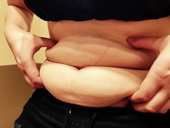 サロンド ヴィーナス 葛西店/ぷよぷよお腹もお任せください