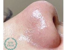 ジェリー(JERRY)/毛穴レス