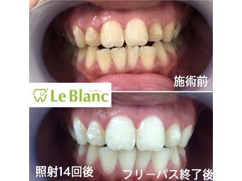 ルブラン 奈良店(Le Blanc)/ホワイトスポット