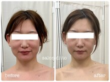 サロンディト(ditto)/【施術1回】小顔コルギ＋肩甲骨