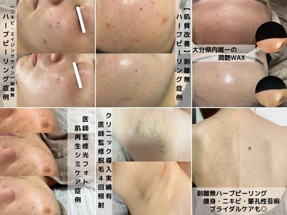 ビジュー(美柔 Bijou)の写真