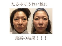 札幌小顔屋の雰囲気（各お悩みに対しての専門性を武器に結果にこだわります。根本改善）