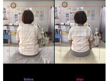 ストレチックス 近江八幡店/BeforeAfter