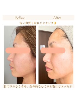 ルルドフォンテ(rurudo fonte.)/トーンアップ!