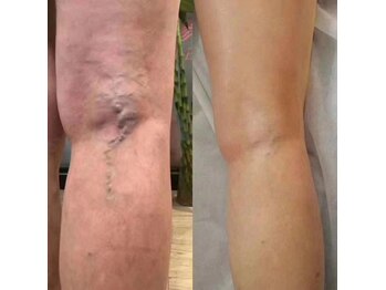 ルルビューティー/