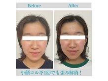 コルギ1回でお悩みの歪み解消！