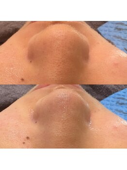 ビーズアモール 大府店(B's amor)/B’s amor 大府店 facial