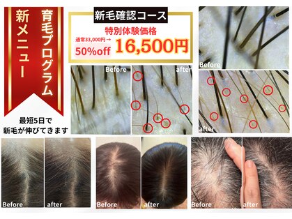 ルポーゼ(Repose)の写真