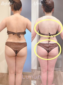 ルノン(Lunon)/【ブライダル】ダイエット1回目