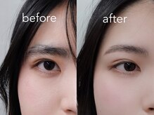 シエナ アイ(CIENA eye)/