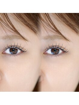 リコ(Rico)の写真/《完全個室×マンツーマン施術》大阪の人気店で店長の経験がある経験豊富なスタッフが施術致します♪