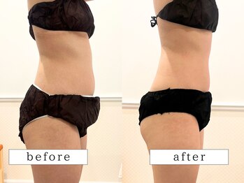 ビューティズムラウンジ(Beautism Lounge)/お腹メラメラ燃焼ボディー