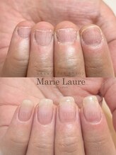 マリーロール 淀屋橋本店(Marie Laure)/自爪育成/深爪矯正/ネイルケア