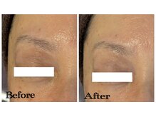 グラサヴォーグ 金沢店/目元の印象に変化が◎