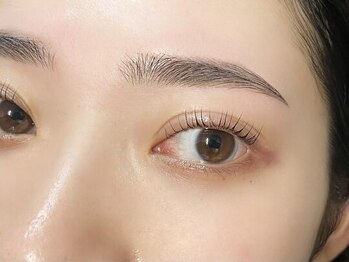 アイズ 天神大名店(eye's)の写真/“お顔のトーン・肌艶アップ”痛みが少ないＷＡＸ脱毛で汚れや古い角質をしっかり落としましょう◎