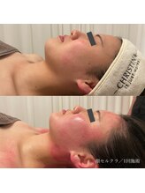 エクラ(eclat)/セルクラ