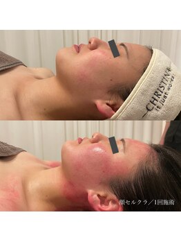 エクラ(eclat)/セルクラ