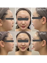 プロラボスパ 倉敷店/20代後半　症例写真