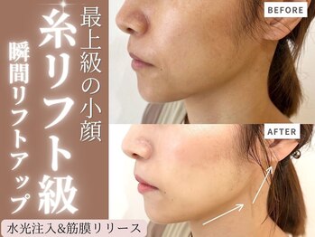 マヴィ 高槻店(MavY.)/最先端マシーン