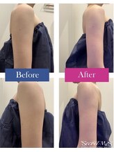 ユフラ(Juhla)/深部高周波＋オイル